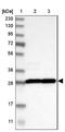 Tyrosine 3-Monooxygenase/Tryptophan 5-Monooxygenase Activation Protein Theta antibody, NBP1-90337, Novus Biologicals, Western Blot image 