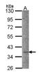 Calcium/calmodulin-dependent protein kinase type 1 antibody, NBP2-15683, Novus Biologicals, Western Blot image 