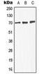 Gamma-Aminobutyric Acid Type A Receptor Alpha4 Subunit antibody, LS-C352225, Lifespan Biosciences, Western Blot image 