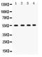 Gap Junction Protein Alpha 3 antibody, PB9596, Boster Biological Technology, Western Blot image 