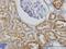 Gamma-Butyrobetaine Hydroxylase 1 antibody, H00008424-M01, Novus Biologicals, Immunohistochemistry paraffin image 