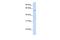 Chromosome 16 Open Reading Frame 71 antibody, GTX45726, GeneTex, Western Blot image 