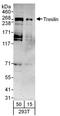 TOPBP1 Interacting Checkpoint And Replication Regulator antibody, A303-472A, Bethyl Labs, Western Blot image 