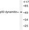 Dynactin Subunit 2 antibody, LS-C176158, Lifespan Biosciences, Western Blot image 