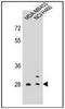 FR-beta antibody, AP51697PU-N, Origene, Western Blot image 