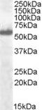 Interferon Regulatory Factor 5 antibody, STJ70233, St John