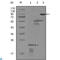 Erb-B2 Receptor Tyrosine Kinase 3 antibody, LS-C813970, Lifespan Biosciences, Western Blot image 