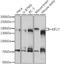 Kinesin Family Member 17 antibody, A06540, Boster Biological Technology, Western Blot image 
