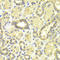 Mitogen-Activated Protein Kinase Kinase 2 antibody, STJ24464, St John