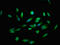 Calcium-transporting ATPase type 2C member 1 antibody, LS-C673755, Lifespan Biosciences, Immunofluorescence image 