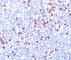 Immunoglobulin Kappa Variable 1D-16 antibody, V2145IHC-7ML, NSJ Bioreagents, Immunohistochemistry paraffin image 