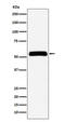 Inosine Monophosphate Dehydrogenase 2 antibody, M03021-1, Boster Biological Technology, Western Blot image 