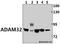 ADAM Metallopeptidase Domain 32 antibody, A13911-1, Boster Biological Technology, Western Blot image 