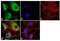 Calcium/calmodulin-dependent protein kinase type 1 antibody, GTX23551, GeneTex, Immunocytochemistry image 