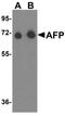 Alpha Fetoprotein antibody, NBP1-76275, Novus Biologicals, Western Blot image 