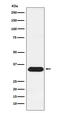 Syndecan Binding Protein antibody, M02475-1, Boster Biological Technology, Western Blot image 