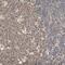 Zinc Finger Matrin-Type 5 antibody, PA5-52123, Invitrogen Antibodies, Immunohistochemistry frozen image 