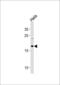 NADH:Ubiquinone Oxidoreductase Subunit B10 antibody, PA5-35277, Invitrogen Antibodies, Western Blot image 