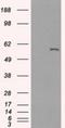 Cytochrome P450 Family 2 Subfamily E Member 1 antibody, NBP2-02155, Novus Biologicals, Western Blot image 