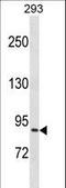 Nuclear Cap Binding Protein Subunit 1 antibody, LS-C157990, Lifespan Biosciences, Western Blot image 