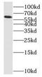 P21 (RAC1) Activated Kinase 1 antibody, FNab06120, FineTest, Western Blot image 