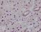 Hepatocyte Nuclear Factor 4 Alpha antibody, M00389, Boster Biological Technology, Immunohistochemistry paraffin image 