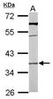 Transmembrane Protein 59 antibody, TA308979, Origene, Western Blot image 