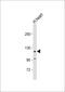 Very Low Density Lipoprotein Receptor antibody, 62-037, ProSci, Western Blot image 