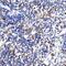 Interleukin 32 antibody, A03286-2, Boster Biological Technology, Immunohistochemistry paraffin image 
