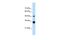 Homeobox C9 antibody, PA5-41125, Invitrogen Antibodies, Western Blot image 