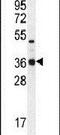 Tryptase Delta 1 antibody, PA5-24002, Invitrogen Antibodies, Western Blot image 