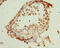 ZW10 Interacting Kinetochore Protein antibody, LS-C676763, Lifespan Biosciences, Immunohistochemistry paraffin image 
