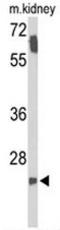 Survival Motor Neuron Domain Containing 1 antibody, AP53946PU-N, Origene, Western Blot image 