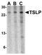 Thymic Stromal Lymphopoietin antibody, LS-B3640, Lifespan Biosciences, Western Blot image 