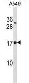 Signal Sequence Receptor Subunit 4 antibody, LS-C161521, Lifespan Biosciences, Western Blot image 