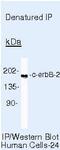 ERBB2 antibody, MA5-13102, Invitrogen Antibodies, Immunoprecipitation image 