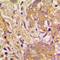 Vascular Endothelial Growth Factor B antibody, LS-C352985, Lifespan Biosciences, Immunohistochemistry frozen image 