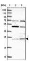 Thymidylate kinase antibody, NBP1-91851, Novus Biologicals, Western Blot image 