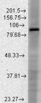 Hyperpolarization Activated Cyclic Nucleotide Gated Potassium Channel 3 antibody, NBP2-12896, Novus Biologicals, Western Blot image 