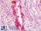 Inositol Polyphosphate-5-Phosphatase A antibody, LS-B11224, Lifespan Biosciences, Immunohistochemistry frozen image 