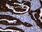 Keratin 84 antibody, M14544, Boster Biological Technology, Immunohistochemistry paraffin image 