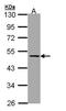 Serpin Family A Member 7 antibody, NBP1-32963, Novus Biologicals, Western Blot image 