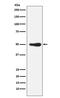 Forkhead Box L2 antibody, M01185, Boster Biological Technology, Western Blot image 