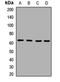 Interleukin 1 Receptor Like 2 antibody, LS-C668249, Lifespan Biosciences, Western Blot image 