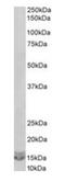 C-X-C Motif Chemokine Ligand 2 antibody, orb20284, Biorbyt, Western Blot image 