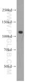 Small G Protein Signaling Modulator 1 antibody, 21395-1-AP, Proteintech Group, Western Blot image 