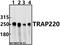 Mediator Complex Subunit 1 antibody, GTX66658, GeneTex, Western Blot image 