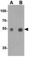Serine Palmitoyltransferase Long Chain Base Subunit 2 antibody, GTX31437, GeneTex, Western Blot image 