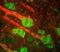 Neurofilament Medium antibody, PA1-32348, Invitrogen Antibodies, Immunofluorescence image 