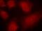 Coactivator Associated Arginine Methyltransferase 1 antibody, A01486, Boster Biological Technology, Immunofluorescence image 
